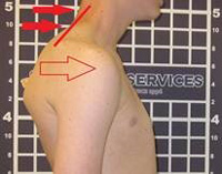 Head-And-Neck