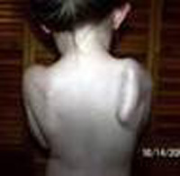 Shoulders