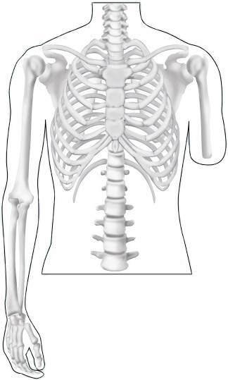 transradial-2